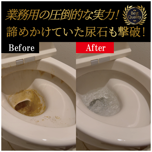 【ホテル・百貨店で使用】業務用 尿石洗浄剤（300ml）
