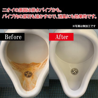 【ホテル・百貨店で使用】業務用 尿石洗浄剤（300ml）